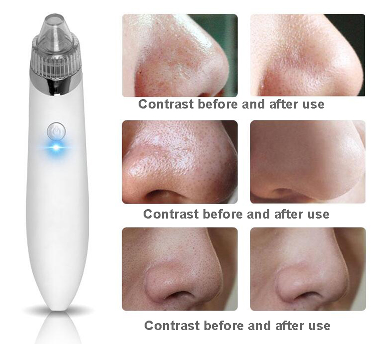 Professional Skin peeling Microdermabrasion home use beauty device vacuum blackhead remover