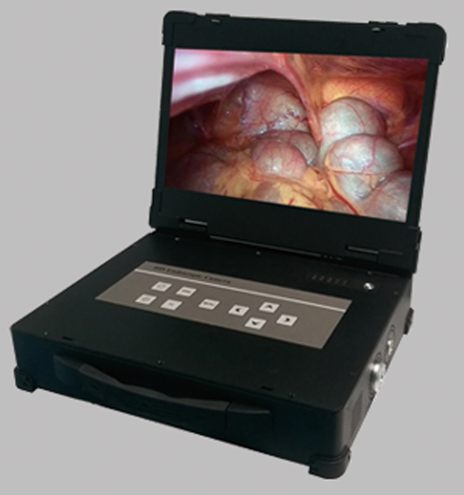 All-in-One Medical Integrated Endoscope Camera System