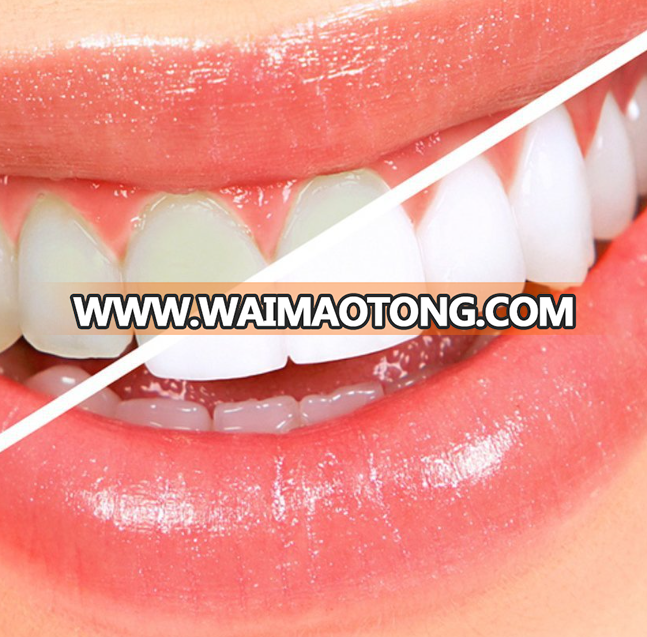 Tooth Whitener Kit Teeth White Light Teeth Whitening Tray Teeth Whitening Gel Dental Care Brightening Tooth