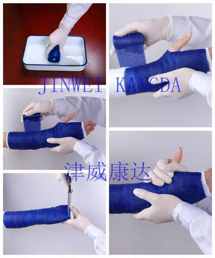 Jinwei Kangda Medical Self Adhesive Casting Tape