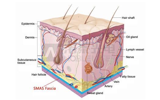 New 3D Hifu Skin Tightening and Shaping Machine